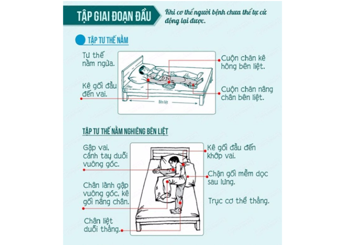 Bài tập phục hồi sau tai biến mạch máu não