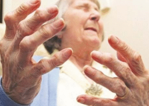 Bệnh gút ở người cao tuổi