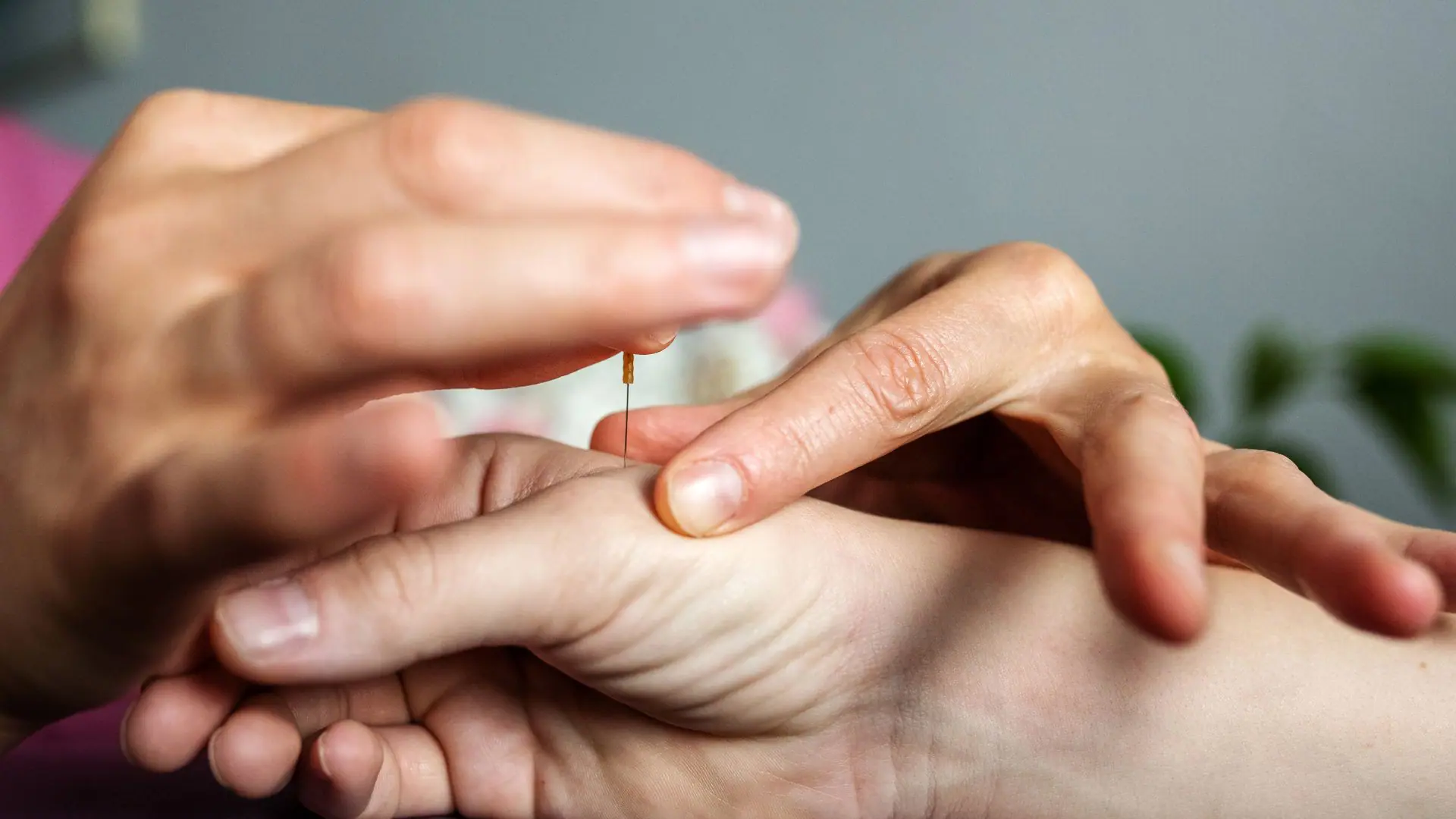 Châm cứu bấm huyệt trị liệu