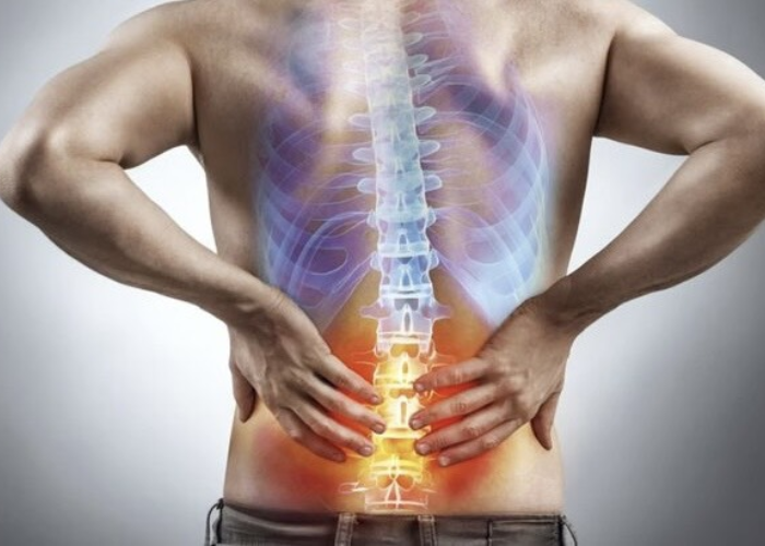 Đau thần kinh tọa