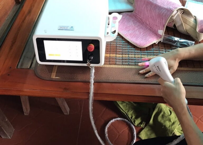 Laser trị liệu xương khớp 
