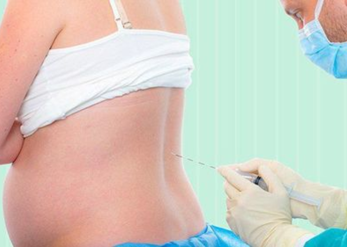 Phẫu thuật Stripping (Rút bỏ tĩnh mạch)