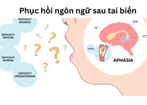 Phục hồi ngôn ngữ sau tai biến