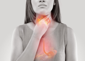 Rối loạn nuốt sau đột quỵ