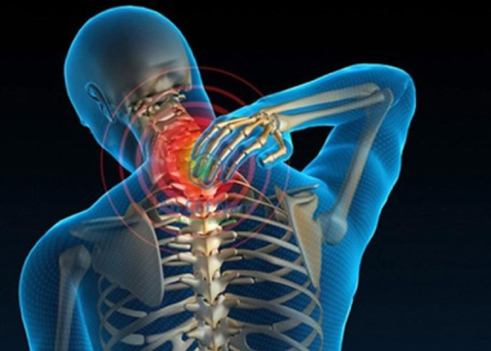 Thoái hóa cột sống cổ