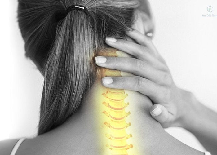 Thoái hóa cột sống cổ