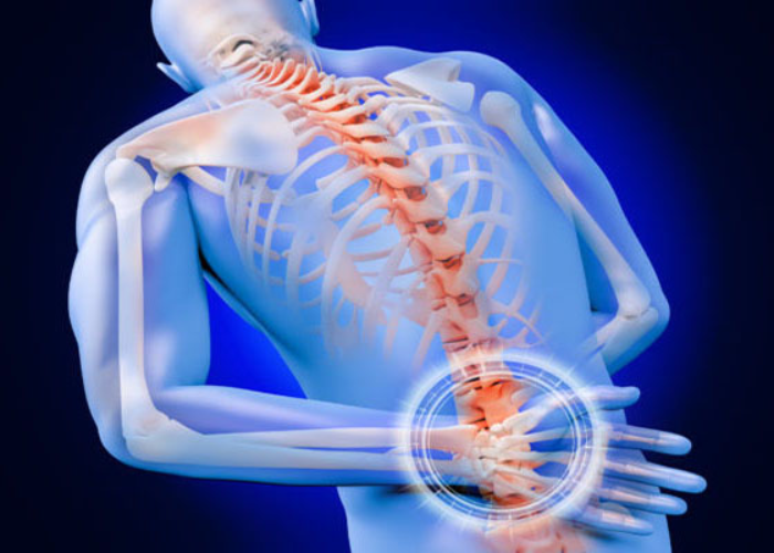 Thoái hóa cột sống thắt lưng