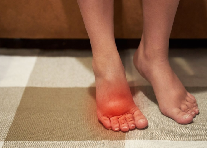 Cách kê chân cao khi ngủ cho người suy giãn tĩnh mạch