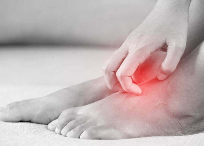 Ngứa vùng da chân do ứ máu