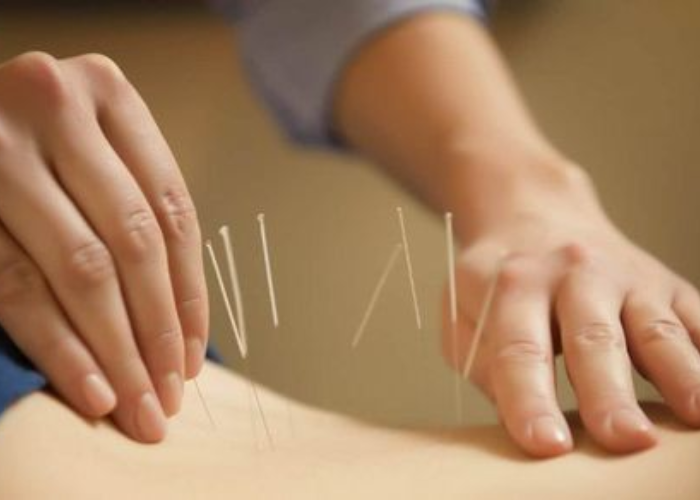 Phục hồi chức năng tâm lý sau tai biến (3)