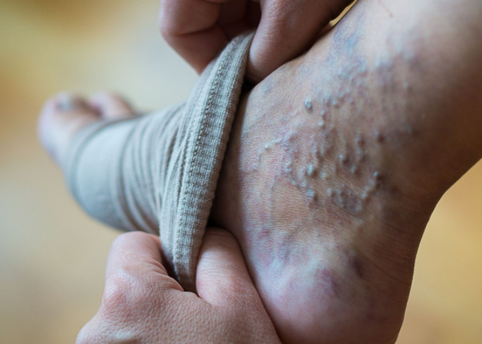 Chạy bộ là bài tập chịu trọng lực tự nhiên giúp tăng mật độ xương và phòng ngừa loãng xương