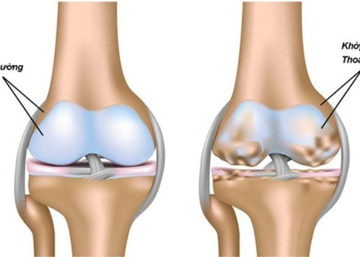 Tác dụng của Glucosamine và Collagen tuýp 2 với sụn khớp