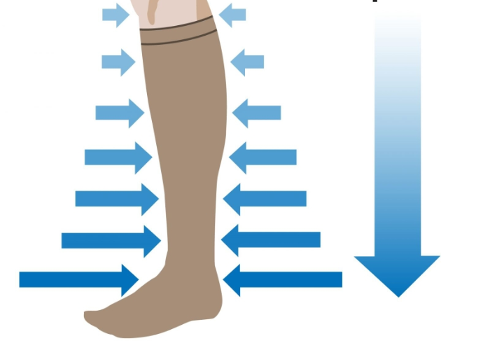 Vớ giãn tĩnh mạch đùi/gối